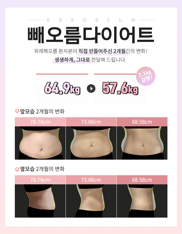 다이어트전후